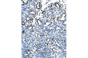 Immunohistochemical staining (Formalin-fixed paraffin-embedded sections) of human lung (A) and human spleen (B) with CLDN17 polyclonal antibody  at 4-8 ug/mL working concentration.