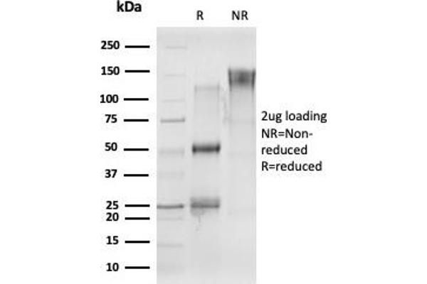 CELF2 antibody