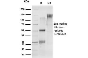 SDS-PAGE Analysis Purified CELF2 Mouse Monoclonal Antibody (PCRP-CELF2-1E4) Confirmation of Purity and Integrity of Antibody. (CELF2 antibody)