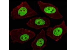 Immunofluorescent analysis of A549 cells using LIN28A antibody at 1:100. (LIN28A antibody  (AA 108-138))