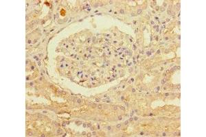 Immunohistochemistry (IHC) image for anti-Patatin-Like phospholipase Domain Containing 1 (PNPLA1) (AA 101-300) antibody (ABIN7162688)