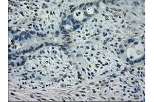Image no. 3 for anti-Signal Transducer and Activator of Transcription 1, 91kDa (STAT1) antibody (ABIN1501168) (STAT1 antibody)