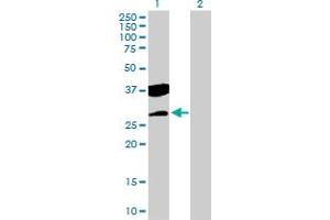 Western Blot analysis of CTDSP2 expression in transfected 293T cell line by CTDSP2 MaxPab polyclonal antibody. (CTDSP2 antibody  (AA 1-271))