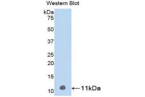 Western Blotting (WB) image for anti-Parathyroid Hormone (PTH) (AA 31-115) antibody (ABIN1078421) (PTH antibody  (AA 31-115))