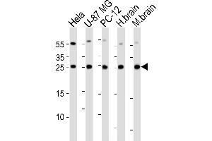 Western blot analysis of lysates from Hela, U-87 MG, rat PC-12 cell line , huamn brain and mouse brain tissue lysate(from left to right), using RAB35 Antibody (C-term) (ABIN6244138 and ABIN6577420). (RAB35 antibody  (C-Term))