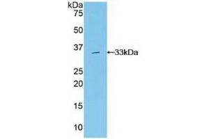 Detection of Recombinant Grb7, Human using Polyclonal Antibody to Growth Factor Receptor Bound Protein 7 (Grb7) (GRB7 antibody  (AA 66-327))