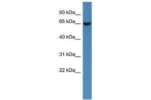 WB Suggested Anti-Gns Antibody Titration: 0. (GNS antibody  (C-Term))