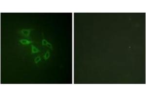 Immunofluorescence analysis of HeLa cells, using PIP5K (Phospho-Ser307) Antibody. (PIKFYVE antibody  (pSer307))