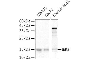 Western blot analysis of extracts of various cell lines, using IER3 antibody (ABIN6134174, ABIN6142158, ABIN6142159 and ABIN6224665) at 1:500 dilution. (IER3 antibody  (C-Term))