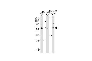 Western blot analysis of lysates from 293,K562,PC-3 cell line (from left to right),using PIP5KL1 Antibody (N-term) (ABIN655244 and ABIN2844847). (PIP5KL1 antibody  (N-Term))