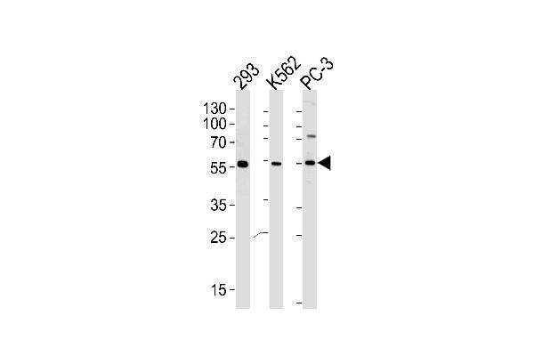 PIP5KL1 anticorps  (N-Term)
