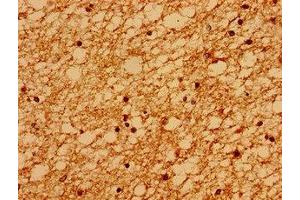 Immunohistochemistry of paraffin-embedded human brain tissue using ABIN7168566 at dilution of 1:100 (Sacsin antibody  (AA 983-1150))