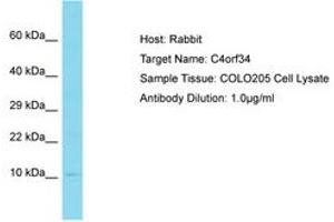 Image no. 1 for anti-Small Integral Membrane Protein 14 (SMIM14) (AA 12-61) antibody (ABIN6750772)
