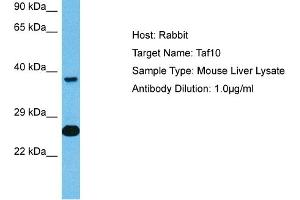 Host: Mouse Target Name: TAF10 Sample Tissue: Mouse Liver Antibody Dilution: 1ug/ml (TAF10 antibody  (C-Term))