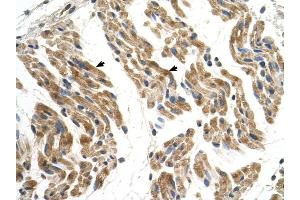 SLC35F2 antibody was used for immunohistochemistry at a concentration of 4-8 ug/ml to stain Skeletal muscle cells (arrows) in Human Muscle. (SLC35F2 antibody  (N-Term))