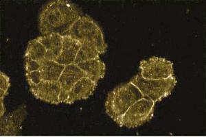 Immunofluorescence staining of A431 cells (Human epithelial carcinoma, ATCC CRL-1555). (FKBP10 antibody  (AA 434-576))