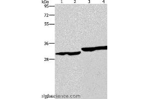 Western blot analysis of Human endometrial carcinoma and colon cancer tissue, human fetal liver tissue and PC3 cell, using DECR1 Polyclonal Antibody at dilution of 1:300