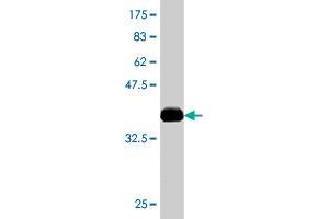 Western Blot detection against Immunogen (37. (ACAA2 antibody  (AA 151-260))