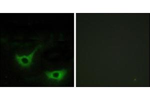 Immunofluorescence analysis of NIH/3T3 cells, using CALR antibody. (Calreticulin antibody)