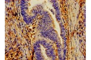 Immunohistochemistry of paraffin-embedded human lung tissue using ABIN7149202 at dilution of 1:100 (CYP1A1 antibody  (AA 97-254))