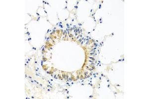 Immunohistochemistry of paraffin-embedded mouse lung using COQ7 antibody at dilution of 1:100 (x40 lens). (Coq7 antibody)