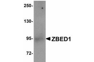 Image no. 1 for anti-Zinc Finger, BED-Type Containing 1 (ZBED1) (Internal Region) antibody (ABIN478064)