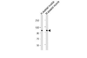 All lanes : Anti-CLCN1 Antibody (N-Term) at 1:2000 dilution Lane 1: Human skeletal muslce lysate Lane 2: Mouse skeletal muscle lysate Lysates/proteins at 20 μg per lane.
