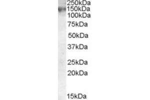 Western Blotting (WB) image for anti-ATP-Binding Cassette, Sub-Family C (CFTR/MRP), Member 1 (ABCC1) (Internal Region) antibody (ABIN2466642) (ABCC1 antibody  (Internal Region))
