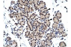 ZNF318 antibody was used for immunohistochemistry at a concentration of 4-8 ug/ml to stain Epithelial cells of pancreatic acinus (arrows) in Human Pancreas.