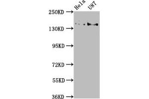 Western Blot Positive WB detected in: Hela whole cell lysate, U87 whole cell lysate All lanes: MYO5A antibody at 1:2000 Secondary Goat polyclonal to rabbit IgG at 1/50000 dilution Predicted band size: 216, 213, 219 kDa Observed band size: 216 kDa (MYO5A antibody  (AA 1087-1220))