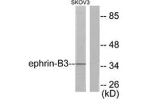 Western blot analysis of extracts from SKOV3 cells, using EFNB3 Antibody. (Ephrin B3 antibody  (AA 221-270))