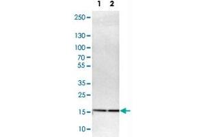 Western Blot analysis of Lane 1: NIH-3T3 cell lysate (mouse embryonic fibroblast cells) and Lane 2: NBT-II cell lysate (Wistar rat bladder tumor cells) with UBE2I polyclonal antibody . (UBE2I antibody)