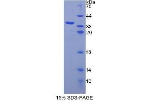 ABCB7 Protein (AA 472-752) (T7 tag,His tag)