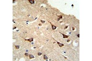 Immunohistochemistry (IHC) image for anti-FYN Oncogene Related To SRC, FGR, YES (FYN) (AA 1-30) antibody (ABIN3031010)