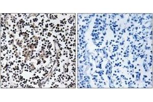 Immunohistochemistry analysis of paraffin-embedded human lymph node tissue, using SLC30A4 Antibody. (SLC30A4 antibody  (AA 71-120))
