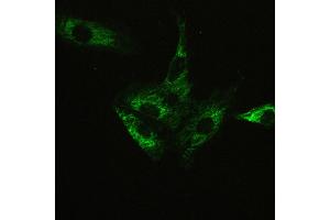 IHC analysis of ATX2 using anti-ATX2 antibody . (Ataxin 2 antibody  (C-Term))