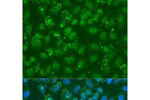 Immunofluorescence analysis of U2OS cells using DGKE Polyclonal Antibody at dilution of 1:100. (DGKE antibody)