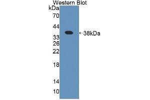Figure. (Amyloid beta Precursor Protein Binding Protein 1 (AA 229-534) antibody)