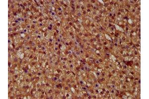 IHC image of ABIN7146322 diluted at 1:400 and staining in paraffin-embedded human adrenal gland tissue performed on a Leica BondTM system. (MICU1 antibody  (AA 55-191))