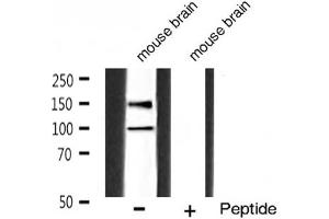 Western blot analysis of IGF1R phosphorylation expression in mouse brain tissue lysates,The lane on the right is treated with the antigen-specific peptide. (IGF1R antibody  (pTyr1165, pTyr1166))