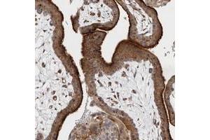 Immunohistochemical staining of human placenta with BNIP2 polyclonal antibody  shows strong cytoplasmic positivity in trophoblastic cells. (BNIP2 antibody)