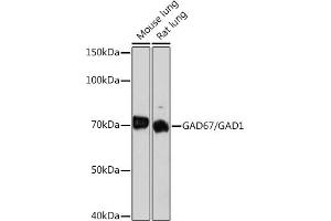 Western blot analysis of extracts of various cell lines, using G/G Rabbit mAb (ABIN7267410) at 1:1000 dilution. (GAD antibody)