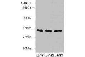 Western blot All lanes: EXOSC8 antibody at 4 μg/mL Lane 1: Mouse small intestine tissue Lane 2: Hela whole cell lysate Lane 3: K562 whole cell lysate Secondary Goat polyclonal to rabbit IgG at 1/10000 dilution Predicted band size: 31 kDa Observed band size: 31 kDa (EXOSC8 antibody  (AA 2-276))
