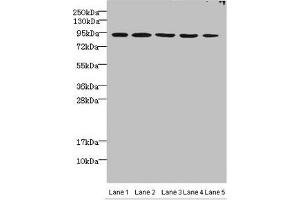 Western blot All lanes: THOC1 antibody at 3 μg/mL Lane 1: Jurkats whole cell lysate Lane 2: 293T whole cell lysate Lane 3: HepG2 whole cell lysate Lane 4: A549 whole cell lysate Lane 5: Mouse kidney tissue Secondary Goat polyclonal to rabbit IgG at 1/10000 dilution Predicted band size: 76, 44 kDa Observed band size: 76 kDa (THOC1 antibody  (AA 428-657))