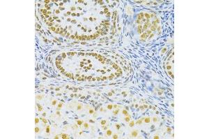 Immunohistochemistry of paraffin-embedded rat ovary using SNRNP70 antibody. (SNRNP70 antibody  (AA 150-250))