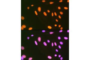 Immunofluorescence analysis of U-2 OS cells using EWSR1 Rabbit mAb (ABIN7267053) at dilution of 1:100 (40x lens). (EWSR1 antibody)