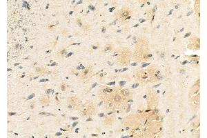 ABIN6261709 and ABIN6273117 at 1/100 staining Rat brain tissue by IHC-P.