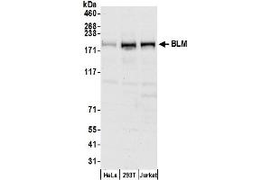 anti-Bloom Syndrome RecQ Like Helicase (BLM) (AA 100-150) antibody