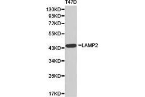 Western Blotting (WB) image for anti-Lysosomal-Associated Membrane Protein 2 (LAMP2) antibody (ABIN1873504) (LAMP2 antibody)