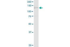 TIMELESS MaxPab rabbit polyclonal antibody. (TIMELESS antibody  (AA 1-1208))